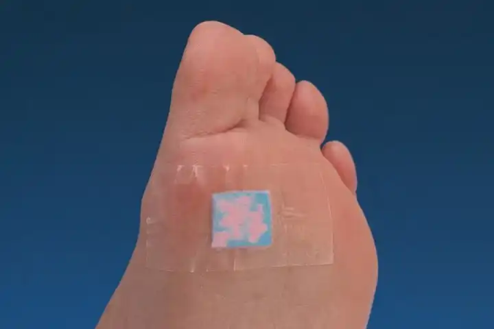 DPN indicator placed on the underside of a patient's foot